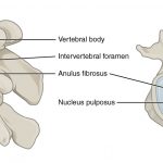 716_Intervertebral_Disk-2